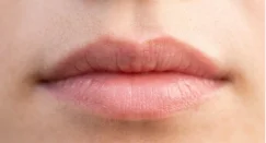 輪郭のぼやけ・左右差が気になる唇